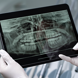 RADIOGRAFIAS